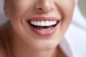 faccette dentali - Studi Medici Odontoiatrici a Nardò